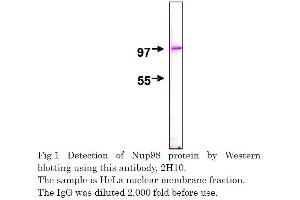 Western Blotting (WB) image for anti-Nucleoporin 98kDa (NUP98) (AA 1-466) antibody (ABIN2452066) (NUP98 anticorps  (AA 1-466))