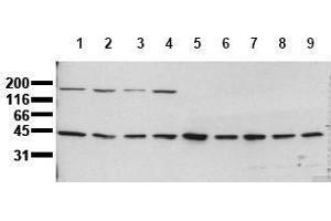 Western Blotting (WB) image for anti-Mitogen-Activated Protein Kinase Kinase 1 (MAP2K1) antibody (ABIN126835) (MEK1 anticorps)