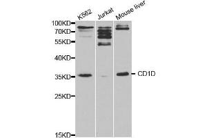 Western blot analysis of extracts of various cell lines, using CD1D antibody. (CD1d anticorps  (AA 20-190))