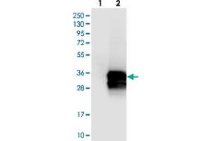 Western blot analysis of Lane 1: Negative control (vector only transfected HEK293T lysate), Lane 2: Over-expression Lysate (Co-expressed with a C-terminal myc-DDK tag (~3. (Calretinin anticorps)