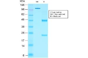 SDS-PAGE Analysis Purified NKX2.