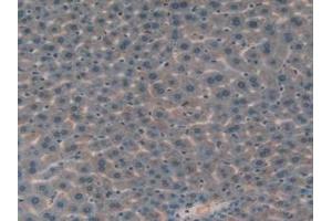 Detection of IGFBP7 in Mouse Liver Tissue using Polyclonal Antibody to Insulin Like Growth Factor Binding Protein 7 (IGFBP7)