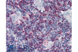 Immunohistochemistry staining of human thymus (paraffin sections) with anti-SLP76 polyclonal.