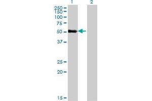 Western Blot analysis of ZNF232 expression in transfected 293T cell line by ZNF232 monoclonal antibody (M06), clone 1F8. (ZNF232 anticorps  (AA 181-280))
