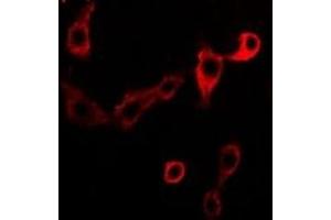 Immunofluorescent analysis of Adenosine Deaminase staining in Jurkat cells. (ADA anticorps)
