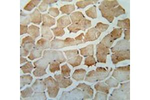 Immunohistochemistry analysis in human skeletal muscle (Formalin-fixed, Paraffin-embedded) using SRBD1  Antibody  (C-term), followed by peroxidase conjugation of the secondary antibody and DAB staining. (SRBD1 anticorps  (C-Term))