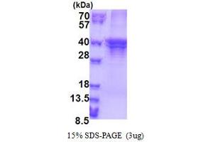 SDS-PAGE (SDS) image for ST3 beta-Galactoside alpha-2,3-Sialyltransferase 5 (ST3GAL5) (AA 83-418) protein (His tag) (ABIN5853358)