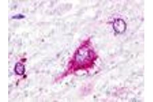 Anti-GPR22 antibody IHC of human brain, neurons and glia. (GPR22 anticorps  (Cytoplasmic Domain))