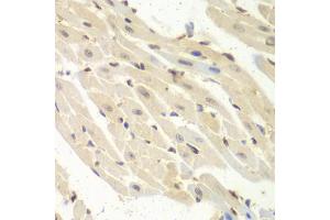 Immunohistochemistry of paraffin-embedded mouse heart using PSME1 antibody (ABIN5973094) at dilution of 1/100 (40x lens). (PSME1 anticorps)