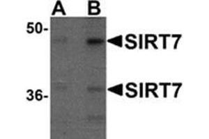 Western blot analysis of SIRT7 in 293 cell lysate with SIRT7 antibody at (A) 0. (SIRT7 anticorps  (N-Term))