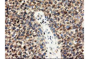 Image no. 7 for anti-ClpP Caseinolytic Peptidase, ATP-Dependent, Proteolytic Subunit Homolog (E. Coli) (CLPP) antibody (ABIN1497535)