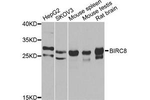 Western blot analysis of extracts of various cell lines, using BIRC8 antibody (ABIN2561421) at 1:1000 dilution. (ILP-2 anticorps)