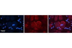 Rabbit Anti-GRIN2C Antibody    Formalin Fixed Paraffin Embedded Tissue: Human Adult heart  Observed Staining: Membrane Primary Antibody Concentration: 1:100 Secondary Antibody: Donkey anti-Rabbit-Cy2/3 Secondary Antibody Concentration: 1:200 Magnification: 20X Exposure Time: 0.
