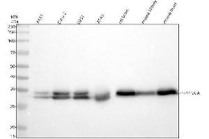 Western blot analysis of P-PPP2CA using anti-P-PPP2CA antibody (ABIN7603449).