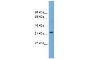 Image no. 1 for anti-PHD Finger Protein 13 (PHF13) (AA 179-228) antibody (ABIN6744908) (PHF13 anticorps  (AA 179-228))