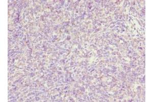 Immunohistochemistry of paraffin-embedded human thymus tissue using ABIN7162470 at dilution of 1:100 (TP53AIP1 anticorps  (AA 1-108))