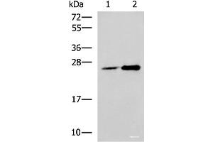 Western blot analysis of 293T cell lysates using DGCR6L Polyclonal Antibody at dilution of 1:800 (DGCR6L anticorps)