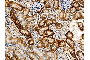 Phospho-TGFBR1 (Thr186) Antibody at 1/100 staining Mouse kidney tissue by IHC-P.