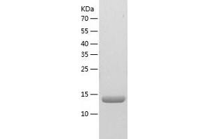 Western Blotting (WB) image for Nucleoside diphosphate kinase B (NME2) (AA 1-152) protein (His tag) (ABIN7124227)