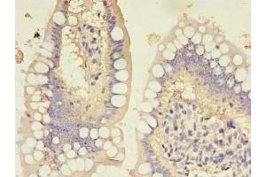 Immunohistochemistry of paraffin-embedded human small intestine tissue using ABIN7154976 at dilution of 1:100