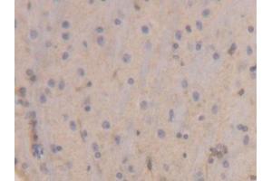IHC-P analysis of Rat Brain Tissue, with DAB staining. (Peroxiredoxin 6 anticorps  (AA 1-224))