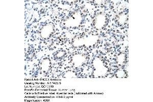 Rabbit Anti-THOC1 Antibody  Paraffin Embedded Tissue: Human Lung Cellular Data: Alveolar cells Antibody Concentration: 4. (THOC1 anticorps  (C-Term))