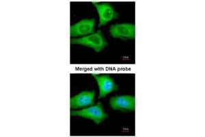 ICC/IF Image Immunofluorescence analysis of paraformaldehyde-fixed HeLa, using TCP-1 epsilon, antibody at 1:200 dilution.