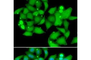 Immunofluorescence analysis of A549 cells using UBASH3B Polyclonal Antibody (UBASH3B anticorps)