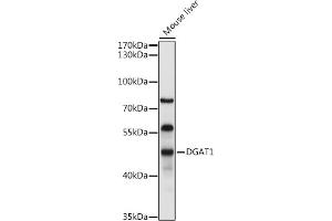 Western blot analysis of extracts of Mouse liver, using DG antibody (ABIN6134325, ABIN6139556, ABIN6139557 and ABIN6222582) at 1:1000 dilution.
