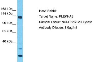 Host: Rabbit Target Name: PLEKHA5 Sample Type: NCI-H226 Whole Cell lysates Antibody Dilution: 1.