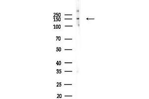 Western blot analysis of lysates from COLO205 cells, using B Antibody at 1/1000 dilution.