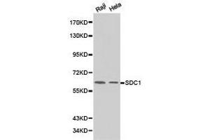 Western Blotting (WB) image for anti-Syndecan 1 (SDC1) antibody (ABIN1874708) (Syndecan 1 anticorps)