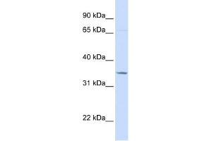 TOLLIP antibody used at 1 ug/ml to detect target protein. (TOLLIP anticorps  (C-Term))