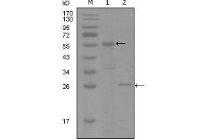 Western Blot showing PGR antibody used against truncated MBP-PGR recombinant protein (1) and truncated Trx-PGR (aa730-871) recombinant protein (2). (Progesterone Receptor anticorps  (AA 730-871))