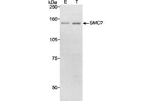 Western Blotting (WB) image for anti-Structural Maintenance of Chromosomes 2 (SMC2) (AA 50-100) antibody (ABIN7449269) (SMC2 anticorps  (AA 50-100))