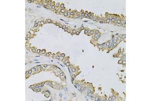 Immunohistochemistry of paraffin-embedded human prostate using APRT Antibody (ABIN6291536) at dilution of 1:100 (40x lens).