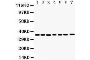 Anti- Annexin A3 Picoband antibody, Western blotting All lanes: Anti Annexin A3  at 0. (Annexin A3 anticorps  (Middle Region))