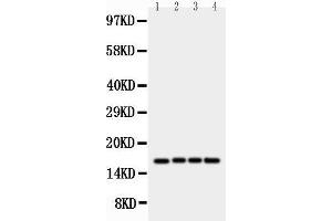 Anti-survivin antibody, Western blotting Lane 1: HELA Cell Lysate Lane 2: JURKAT Cell Lysate Lane 3: CEM Cell Lysate Lane 4: COLO320 Cell Lysate (Survivin anticorps  (C-Term))