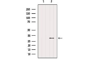 Western blot analysis of extracts from Mouse muscle, using E2F6 Antibody. (E2F6 anticorps  (Internal Region))