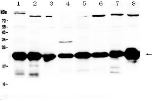 Western blot analysis of PARK7 / DJ1 using anti-PARK7 / DJ1 antibody .