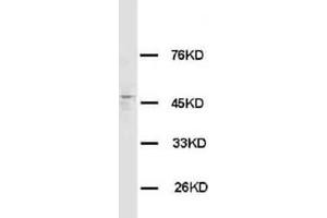 HRH3 Polyclonal Antibody (HRH3 anticorps  (C-Term))
