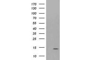 Western Blotting (WB) image for anti-ATPase, H+ Transporting, Lysosomal 14kDa, V1 Subunit F (ATP6V1F) antibody (ABIN1496778)