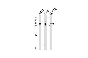 p27Kip1 Antibody (N-term S12) (ABIN1881620 and ABIN2838923) western blot analysis in A431,Hela,mouse C2C12 cell line lysates (35 μg/lane). (CDKN1B anticorps  (N-Term))
