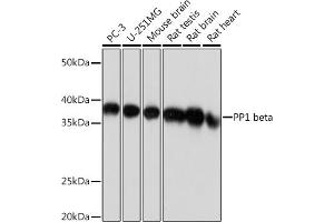 Western blot analysis of extracts of various cell lines, using PP1 beta Rabbit mAb (ABIN1679819, ABIN3018859, ABIN3018860 and ABIN7101675) at 1:1000 dilution. (PPP1CB anticorps)