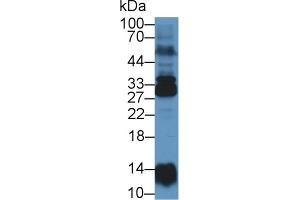 Western Blot; Sample: Human Lung lysate; Primary Ab: 1µg/ml Rabbit Anti-Human NME6 Antibody Second Ab: 0.