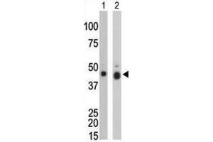 Western Blotting (WB) image for anti-Creatine Kinase, Brain (CKB) antibody (ABIN3002965) (CKB anticorps)