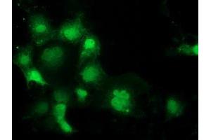 Anti-SPR mouse monoclonal antibody (ABIN2453680) immunofluorescent staining of COS7 cells transiently transfected by pCMV6-ENTRY SPR (RC205679). (SPR anticorps)