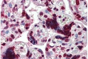 Human Placenta: Formalin-Fixed, Paraffin-Embedded (FFPE) (HMGA1 anticorps  (AA 9-21))