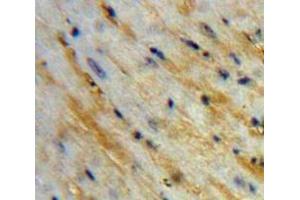 Used in DAB staining on fromalin fixed paraffin-embedded Heart tissue