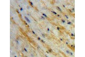Used in DAB staining on fromalin fixed paraffin-embedded Heart tissue (Corin anticorps  (AA 521-637))